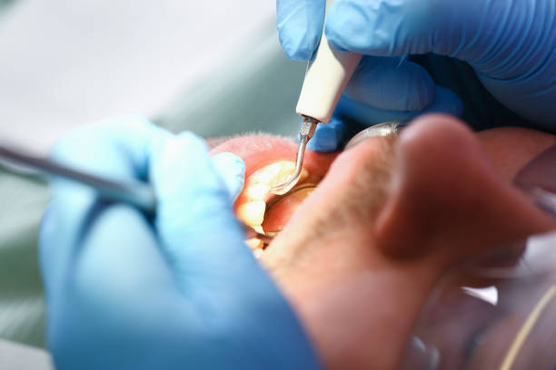 Best Pediatric Emergency Dentist in Friday Harbor, WA