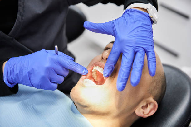 Best Emergency Dentist for Lost Fillings or Crowns in Friday Harbor, WA